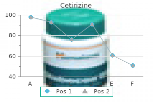 discount generic cetirizine uk