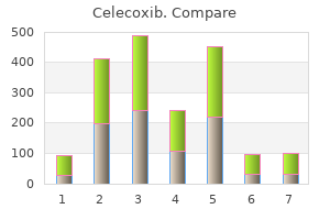 celecoxib 200 mg mastercard