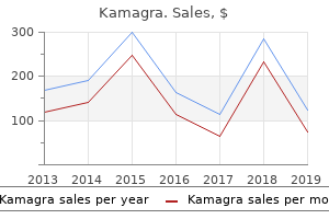 buy cheap kamagra 100mg line