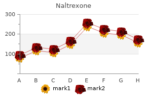 generic naltrexone 50 mg without a prescription