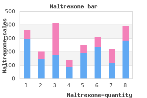 order naltrexone 50 mg fast delivery