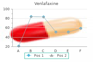 purchase venlafaxine cheap online