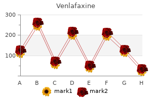 purchase venlafaxine pills in toronto