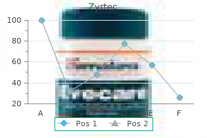 best buy zyrtec