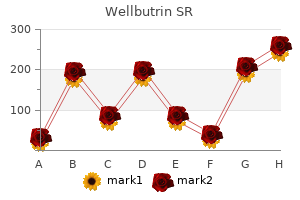 wellbutrin sr 150 mg online