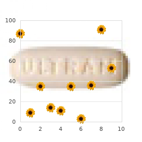 Radial defect Robin sequence