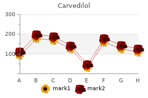 12.5mg carvedilol amex