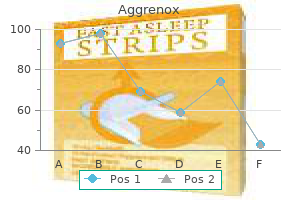 order aggrenox caps toronto