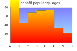 purchase generic sildenafil