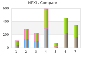 buy npxl with american express