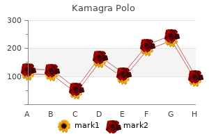 order kamagra polo with a mastercard