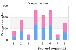 order cheap propecia on-line